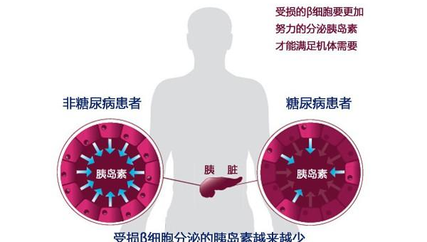 铬元素对胰岛素的作用是什么,铬元素对胰岛素的作用,你了解其影响吗?