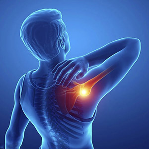 肩周炎怎么治疗,哪些方法最有效？