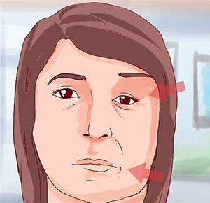 中风后遗症有哪些，如何预防和治疗？