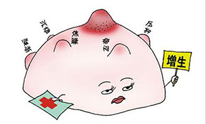 哺乳期乳腺增生怎么办，有哪些预防措施？