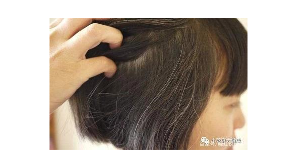 白头发吃维生素b有用吗，白头发吃维生素B真的有效吗？